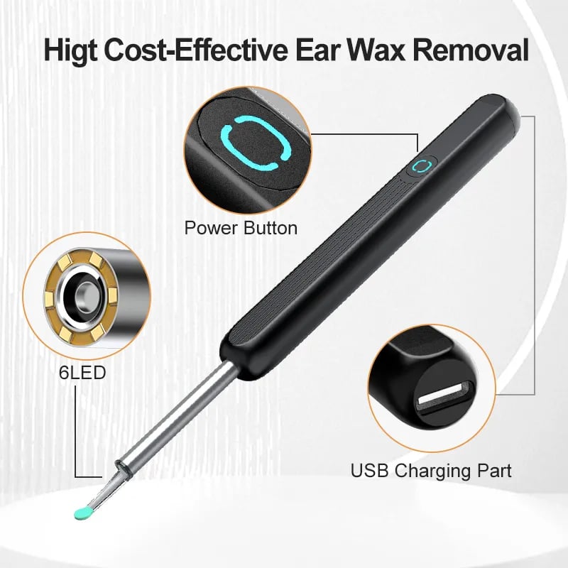 Visual Earwax Removal Kit 👂✨